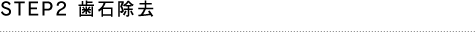 STEP2 歯石除去