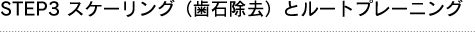 STEP3 スケーリング（歯石除去）とルートプレーニング