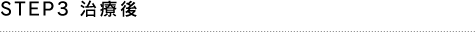 STEP3 治療後