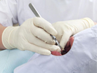 STEP3 抜歯後の消毒と確認