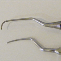 痛くない歯石除去