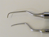 STEP3 スケーリング（歯石除去）とルートプレーニング