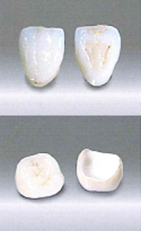 カタナ ジルコニアクラウン