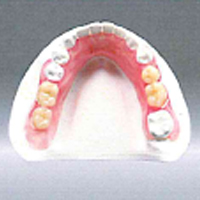 ナチュラルデンチャー