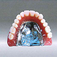 金属床義歯